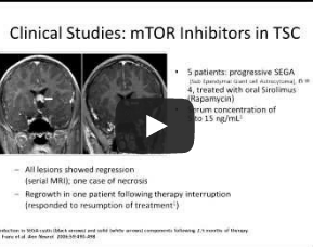 Chris Kingswood talks TSC, kidneys, mTOR inhibitors and the future prevention of TSC (video)