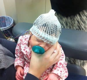 A gorgeous TSC baby having an EEG